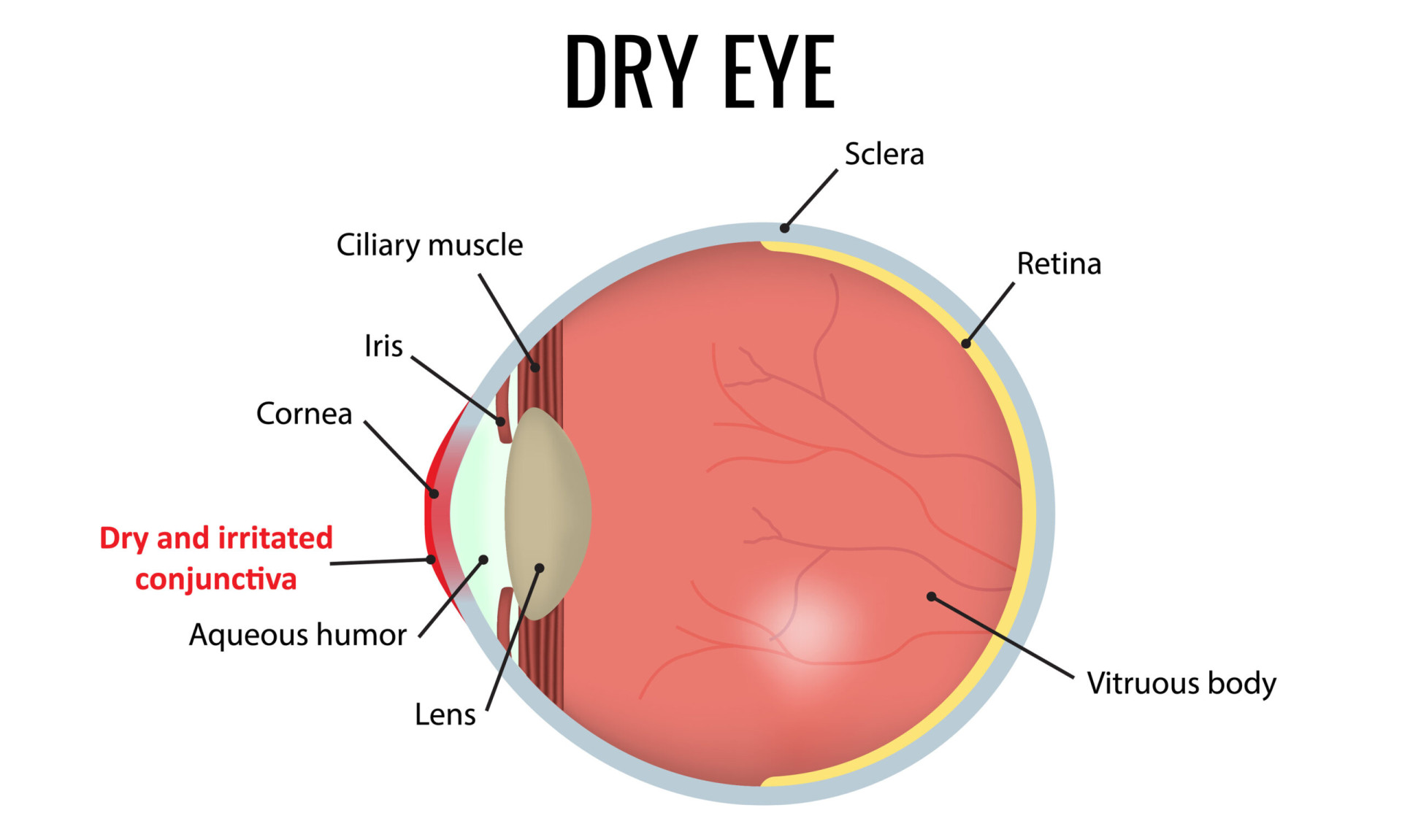 Graystone Dry Eye Services